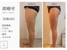 サロン ド パーフェクション(Salon de Perfection)/ボディマカロン
