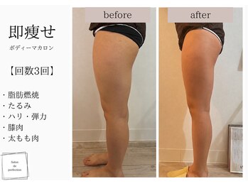 サロン ド パーフェクション(Salon de Perfection)/ボディマカロン
