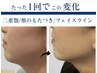 【首肩こり、食いしばり、眼精疲労】強圧小顔コルギフェイシャル60￥9000→