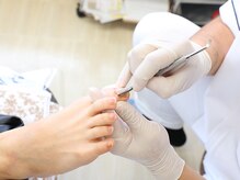 足のケア アンド 巻き爪 エムズ 白金通り店(M's)/ネイルトータルケア2
