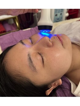 ティアラ(TIARA)/エレクトロポレーション