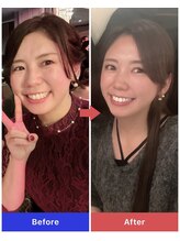 ヨサパーク エルメ 経堂(YOSA PARK Herme)/見た目痩せしたいならルルオン！