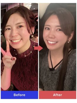 ヨサパーク エルメ 経堂(YOSA PARK Herme)/見た目痩せしたいならルルオン！