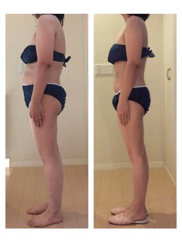 ホロニック ベルサンテ(Holonic Belle Sante)/メディセルハイブリッド