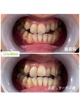 ルブラン 奈良店(Le Blanc)/お得なお試しクーポン