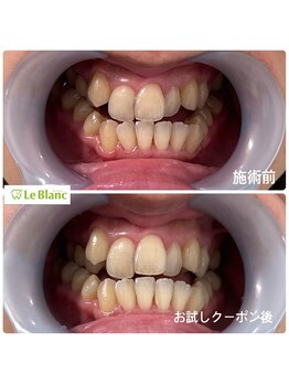 ルブラン 奈良店(Le Blanc)/お得なお試しクーポン