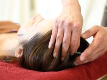 ノエルアシヤ(Noel ASHIYA)/