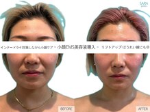 サラ 恵比寿店(SARA)の雰囲気（【小顔EMS美容液導入】フェイシャル/小顔/乾燥/リフトアップ）