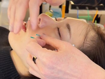 アオヤマ サロン ワイゼット(AOYAMA SALON YZ)の写真/《マンツーマン施術が人気》プライベート空間での美容鍼◎首肩こりや睡眠の悩みもご相談を！20時まで営業◎