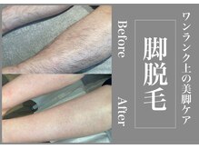 さくら通りクリニック/艶肌美脚ケア！脚脱毛◎