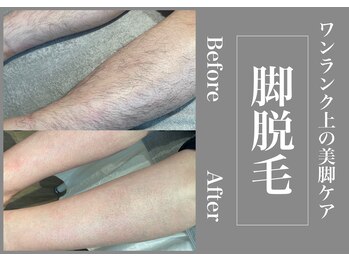 さくら通りクリニック/艶肌美脚ケア!脚脱毛◎