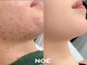 ノエ 新宿(NOE)の写真