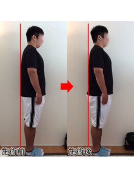 整体院プラス/猫背矯正モニター