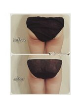 レーヌ青山(Reine Aoyama)/【施術】インディバで内蔵温活