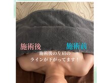 辛い首や肩のコリで上がった肩のラインも下げてスッキリボディに