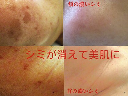 サロンドエステケイワイ(de KY)の写真