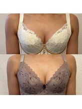 ハル 水戸市(HaRu)/バストメニューも◎