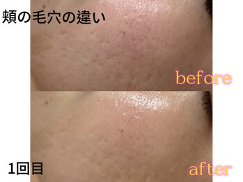 リボーン(be reborn)/頬の毛穴も目立たなく◎