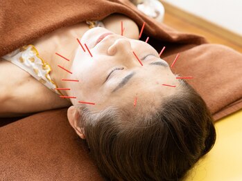 はな鍼灸院/美容鍼2