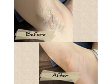 レルア(Relua)の雰囲気（気になるムダ毛もその日にきれいになるのがWAX脱毛の魅力。）