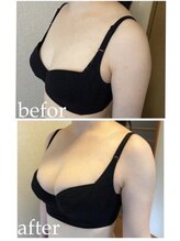 美人バスト 渋谷店/【バストアップ・育乳】◇症例◇