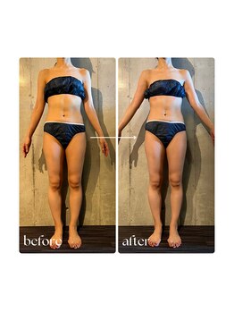 ボーレーヴ 表参道店(beaureve)/施術効果写真(before after)