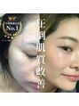 リメイクビューティークリニック(REMAKE BEAUTY CLINIC) 左22歳右26歳どちらのお肌になりたいですか？