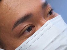 モルフォム(Morphome)/ハリウッドブロウリフト（HBL）