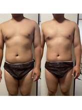 ティグレ 岡山店(TIGRE)/メンズ全身痩身