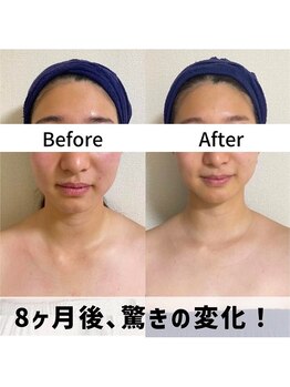 お顔の研究所/ビフォーアフター写真♪