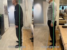 グレフル鍼灸接骨院 整体院 心斎橋/脊柱管狭窄／腰痛／全身整体