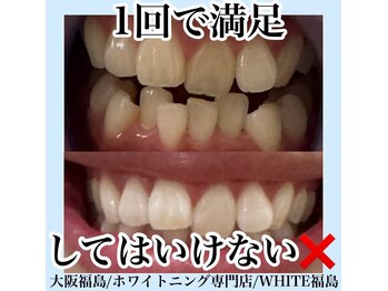ホワイトニングサロン ホワイト(WHITE)/セルフホワイトニング/大阪/福島