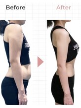 ホッコリ 段原店(HOKKORI)/寝たまま痩身ダイエット