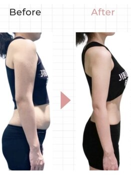 ホッコリ 段原店(HOKKORI)/寝たまま痩身ダイエット