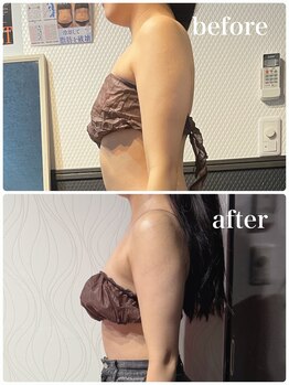 ピーラトゥ 日立(P-Ratu)/ブライダルコース