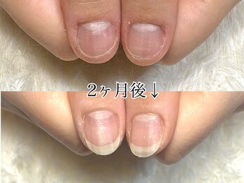 グラシナ 鳥丸店/(深爪/長さだし/フィルイン/)