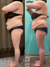 エステサロン 美飾り イオンモール木更津店/before⇒afteｒ/全身痩せ