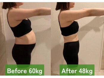 ヨサパーク ルナ(YOSA PARK)/これが3ヶ月の結果!?