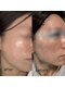 ララ(Lala)の写真/【結果重視本格ピーリング】ニキビ,シミ,くすみなどのお肌のトータル悩みを解決！トラブルに負けない肌へ