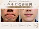 プリベンティブ ビューティー ティップス(Preventive Beauty Tips)の写真