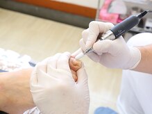 足のケア アンド 巻き爪 エムズ 白金通り店(M's)/ネイルトータルケア3