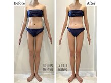 ルヴィカカリーナ(REVI Cacalena)/全身リンパボディメイクコース