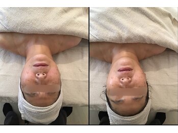 サロン シエラ/施術1回 &nbsp;50代