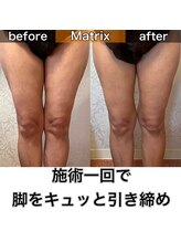 サロンデイジー(Salon Daisy)/Matrix痩身☆施術一回