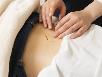 武蔵小杉鍼灸接骨院/腰痛改善