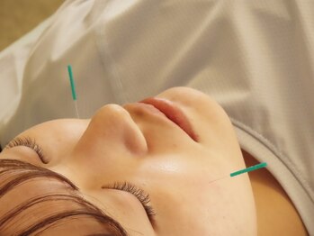 小笠原鍼灸接骨院の写真/《何度でも通いやすい”低価格”》お着替えのご用意あり◎お仕事帰り、隙間時間にも通っていただけます！