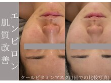 美容整骨サロン リペア(Repair)の雰囲気（繰り返すトラブルに本格肌質改善!全身で原因を特定し改善に導く）