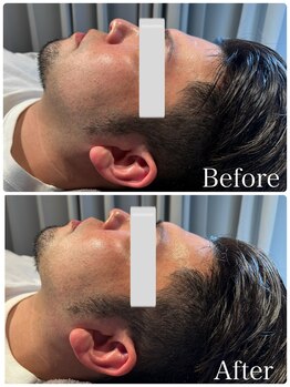 エッセンシャル 南海難波店(ESSENTIAL)/光フォト¥7,000