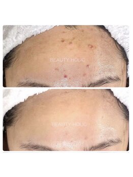 ビューティーホリック 蘇我店(BEAUTY HOLIC)/