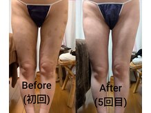 リラージェ 池袋(Relaje)/インディバ術*後ケア